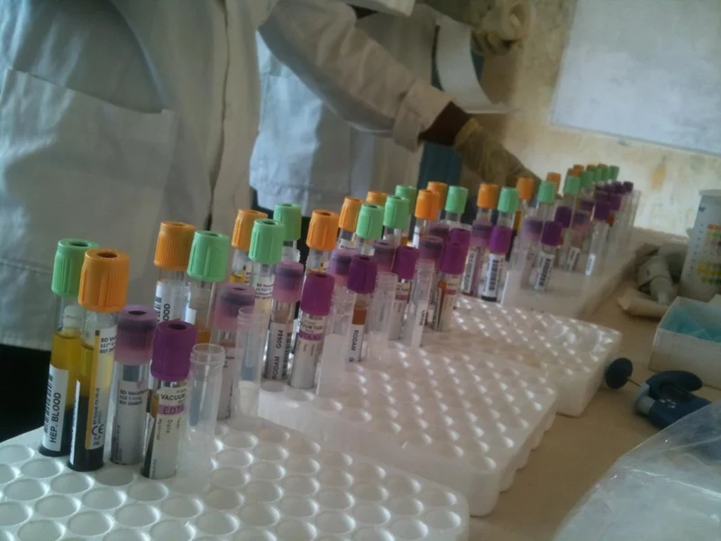RODAM_BloodSampling_CopyrightEllisOwusu-Dabo.webp